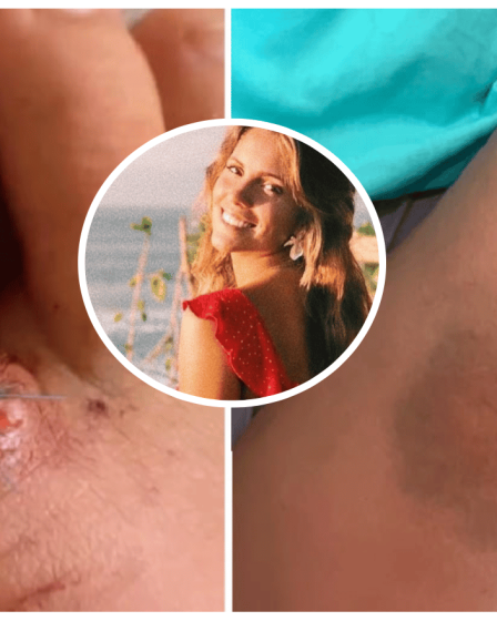 Bain de sang à The Pass, spot de surf australien sans foi ni loi, alors qu'une femme subit d'horribles blessures suite à une collision avec un surfeur "insincère". "C'est comme s'il n'y avait pas de règles là-bas parfois !". - BeachGrit 120 Bain de sang à The Pass, spot de surf australien sans foi ni loi, alors qu'une femme subit d'horribles blessures suite à une collision avec un surfeur "insincère". "C'est comme s'il n'y avait pas de règles là-bas parfois !". - BeachGrit - 119