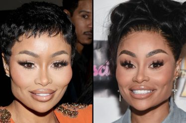 Blac Chyna publie une vidéo de transformation du visage après avoir dissous tous ses produits de remplissage - 7