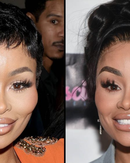 Blac Chyna publie une vidéo de transformation du visage après avoir dissous tous ses produits de remplissage 95 Blac Chyna publie une vidéo de transformation du visage après avoir dissous tous ses produits de remplissage - 94