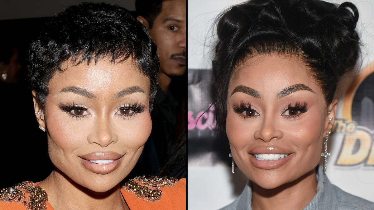 Blac Chyna publie une vidéo de transformation du visage après avoir dissous tous ses produits de remplissage 2 Blac Chyna publie une vidéo de transformation du visage après avoir dissous tous ses produits de remplissage - 1