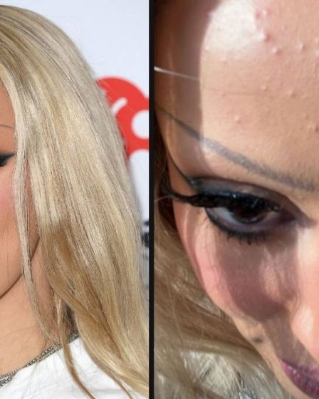 Doja Cat partage une photo non éditée de sa peau après l'apparition du iHeart Radio Award - 75