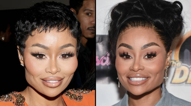 Blac Chyna publie une vidéo de transformation du visage après avoir dissous tous ses produits de remplissage 3 Blac Chyna montre une transformation du visage après avoir dissous ses charges