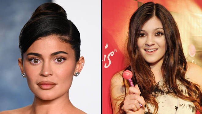 Kylie Jenner parle de la chirurgie plastique qu'elle a subie sur son visage 2 Kylie Jenner parle de la chirurgie plastique qu'elle a subie sur son visage - 1