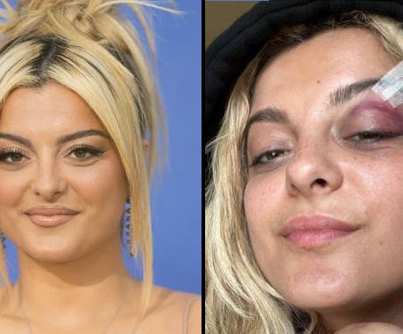 Un fan de Bebe Rexha dit qu'il lui a jeté un téléphone parce qu'il pensait que ce serait "drôle" 66 Un fan de Bebe Rexha dit qu'il lui a jeté un téléphone parce qu'il pensait que ce serait "drôle" - 65