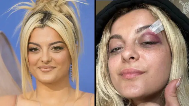Un fan de Bebe Rexha dit qu'il lui a jeté un téléphone parce qu'il pensait que ce serait "drôle" 3 Un fan de Bebe Rexha dit qu'il lui a jeté un téléphone parce qu'il pensait que ce serait