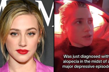 Lili Reinhart partage qu'on lui a diagnostiqué une alopécie - 7