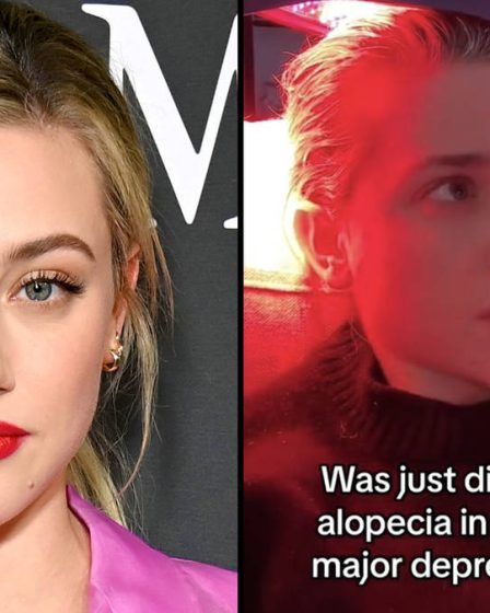 Lili Reinhart partage qu'on lui a diagnostiqué une alopécie 128 Lili Reinhart partage qu'on lui a diagnostiqué une alopécie - 127