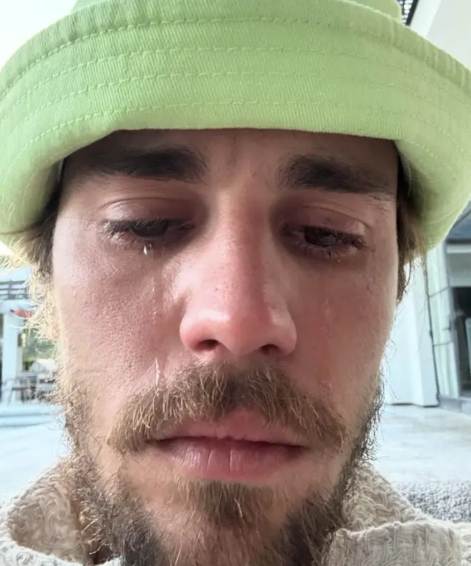 Pourquoi Justin Bieber pleurait-il dans une récente publication sur les réseaux sociaux ? 4 Justin Bieber partage une photo de lui en train de pleurer