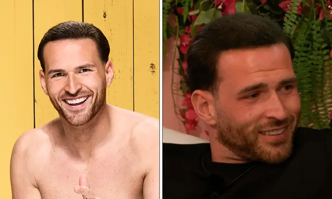 Ronnie Vint de Love Island porte-t-il une perruque ? 3 Ronnie Vint a rejoint Love Island 2024 dans le cadre du casting original
