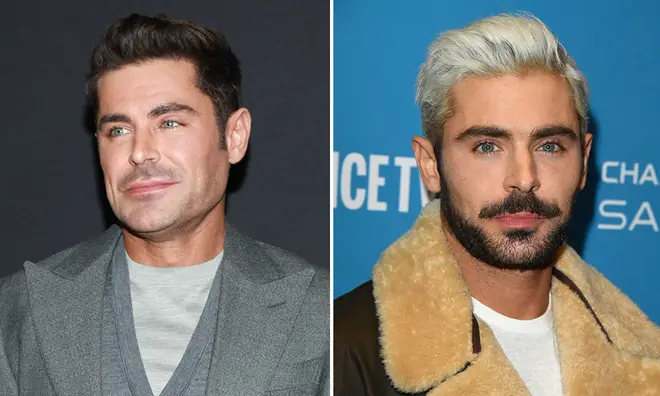La blessure à la mâchoire et la chirurgie plastique de Zac Efron expliquées 3 Zac Efron a nié avoir subi une chirurgie plastique