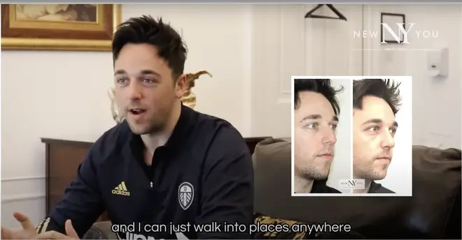 Sam de Love Is Blind UK avant et après sa transformation du nez 5 Sam Klein s'est rendu à New You pour subir son intervention