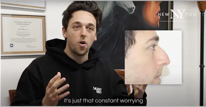 Sam de Love Is Blind UK avant et après sa transformation du nez 6 Sam Klein aurait subi une rhinoplastie par ultrasons