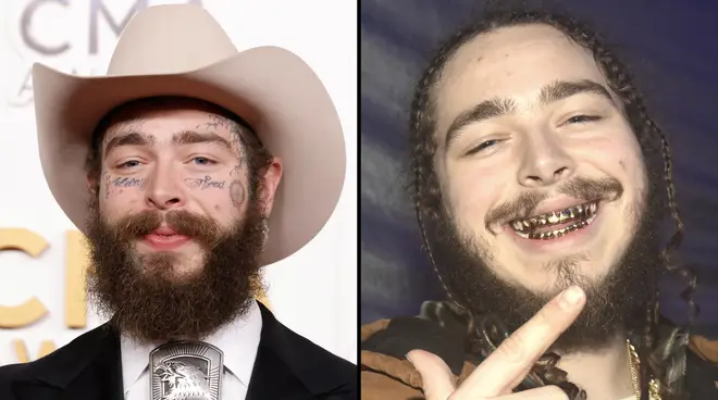Post Malone dit qu'il s'est tourné vers l'alcool suite aux réactions négatives du "vautour culturel" 3 Post Malone dit qu'il a bu de l'alcool pour supporter d'être traité de A