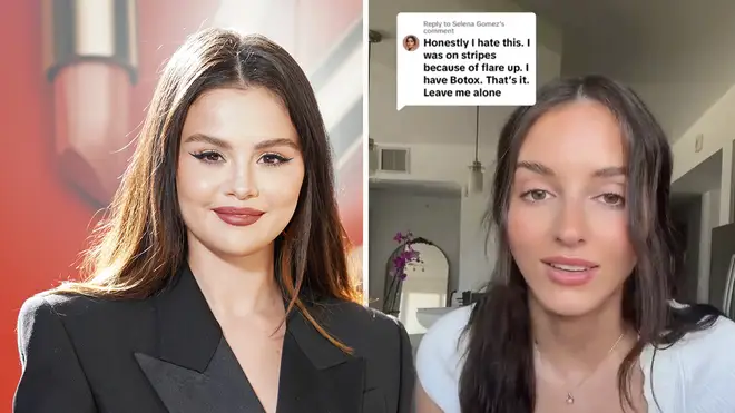 Selena Gomez laisse un commentaire frustré sur une vidéo virale sur sa chirurgie esthétique 3 Selena Gomez répond aux spéculations sur son visage