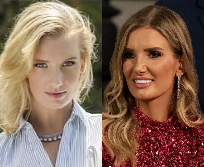Vendre le casting de Sunset avant et après : découvrez leurs transformations beauté 11 Nicole Young avant et après la vente de Sunset