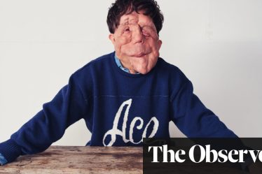 L'acteur Adam Pearson parle de sa célébrité, du cinéma et de sa rivalité fraternelle - 2