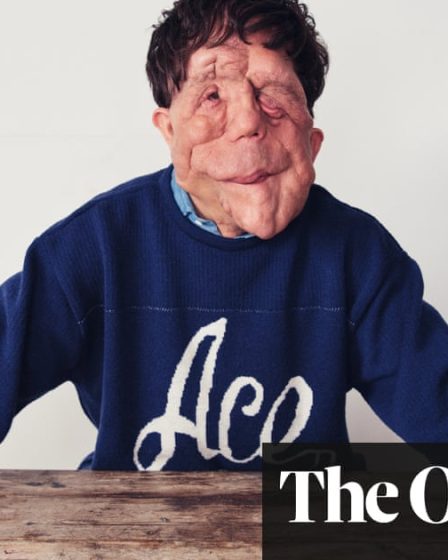 L'acteur Adam Pearson parle de sa célébrité, du cinéma et de sa rivalité fraternelle - 40
