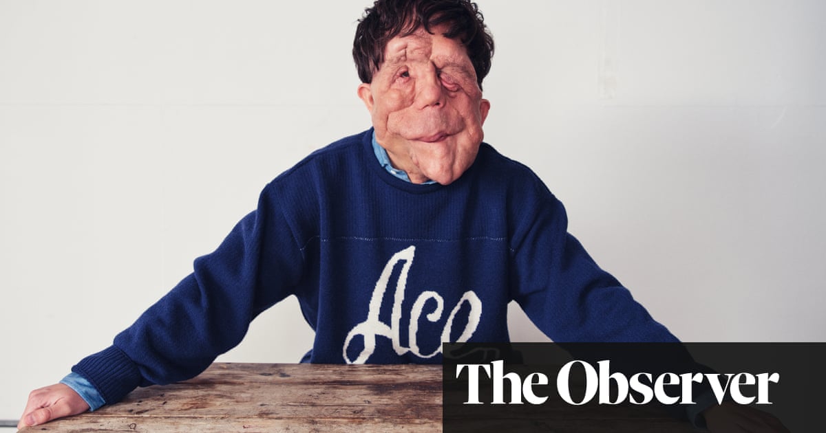 L'acteur Adam Pearson parle de sa célébrité, du cinéma et de sa rivalité fraternelle 2 L'acteur Adam Pearson parle de sa célébrité, du cinéma et de sa rivalité fraternelle - 1