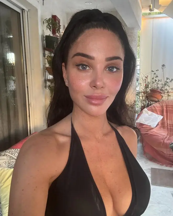 Qui est Tulisa Contostavlos ? Âge, vrai nom, valeur nette, origine ethnique et plus 7 Tulisa souffre de la paralysie de Bell
