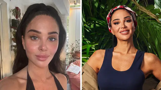 Tulisa de I'm A Celeb explique les raisons médicales des procédures esthétiques et de la chirurgie 3 Tulisa de I'm A Celeb explique la raison médicale des procédures cosmétiques